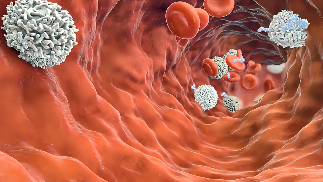 63cm脑瘤昏迷不醒患者仅用15天中药就恢复意识！